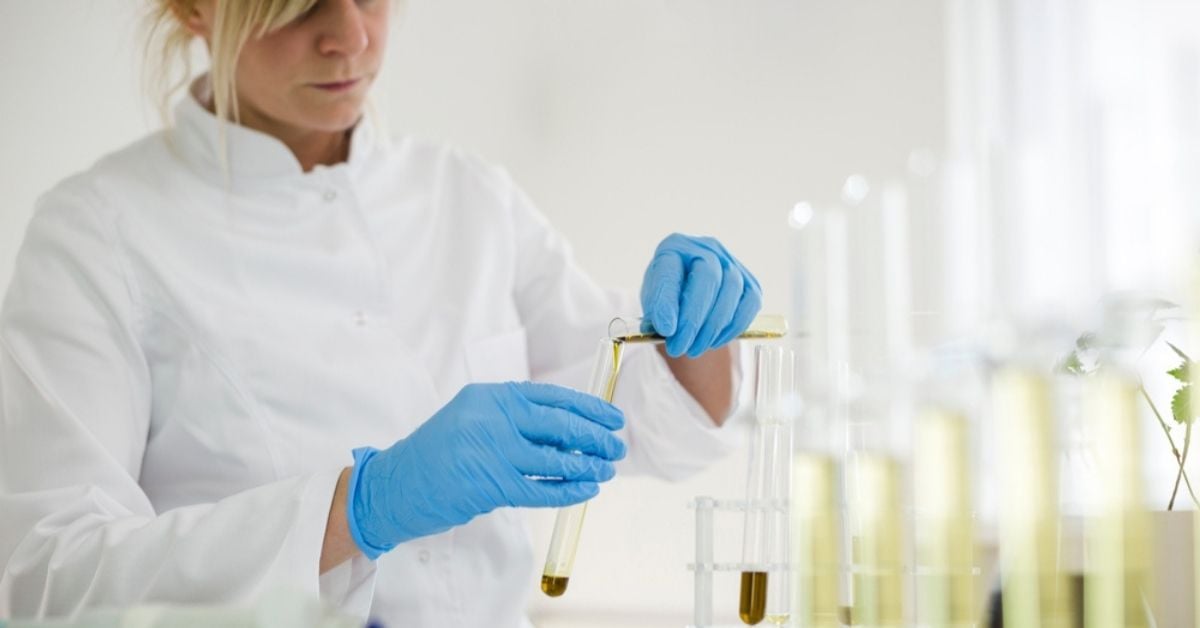 How Do I Understand CBD Test Results?